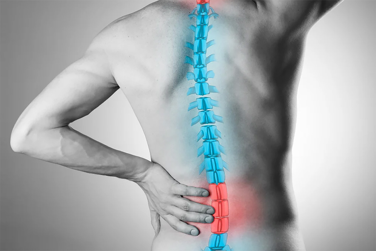 vertebral-fracture-v1